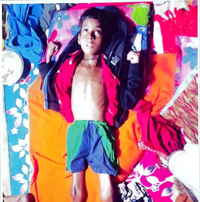 নাজিরপুরে বিরল রোগে আক্রান্ত শিশু সাইমুন বাচঁতে চায়